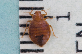 A rash is a common but not definitive clue to the presence of bed bugs Photo courtesy of Richard deShazo MD FACP