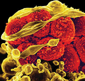 Scanning electron micrograph of methicillin-resistant less-thanigreater-thanStaphylococcus aureusless-thanslashigreater-than bacteria yellow round items killing and escaping from a human white cell Photo by PhotoResearchers