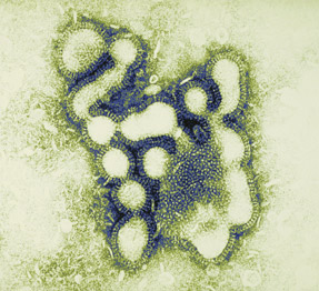 Influenza virus at 295000 times magnification Photo by iStockslashFuse