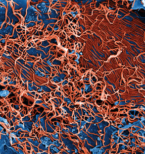 This digitally colorized scanning electron micrograph depicts numerous filamentous Ebolavirus particles red budding from a chronically infected VERO E6 cell blue under a magnification of 25000 ti