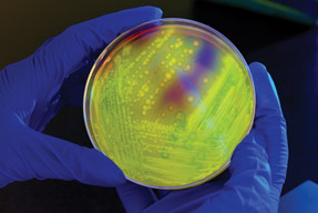 This petri dish culture plate inoculated with less-thanigreater-thanClostridium difficileless-thanslashigreater-than has been illuminated using long-wave UV irradiation causing the bacterial colonies to emit a fluorescent glow Photo by CDCslash