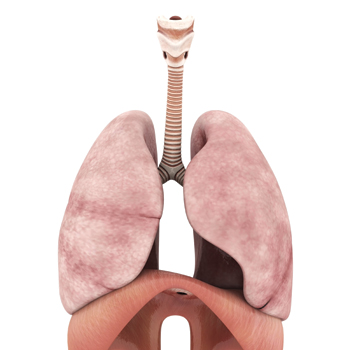 Guidelines for chronic obstructive pulmonary disease which were updated last year now define the condition as persistent respiratory symptoms that occur in the setting of airflow limitation measure
